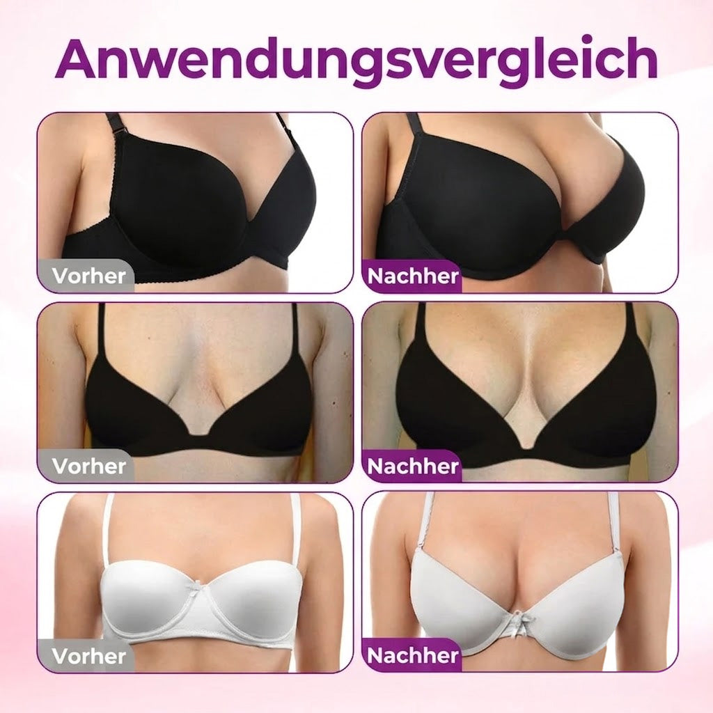 🔥Turonu® Fortschrittliches Nano-Microneedle-Pflaster zur gezielten Brustvergrößerung